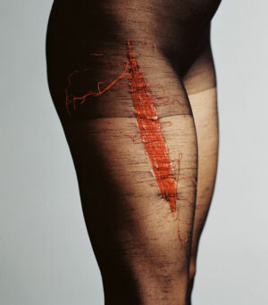 daily wound #10