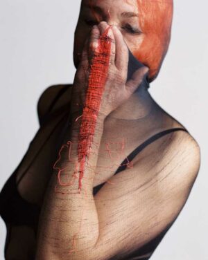 daily wound #07